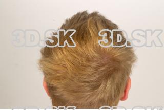 Hair texture of Pat 0007